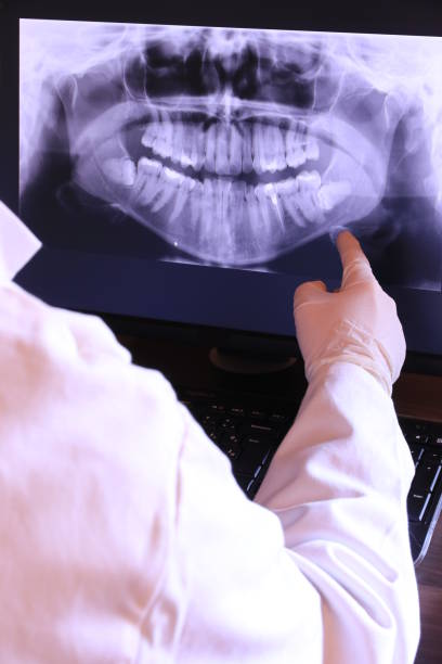 Best Emergency Dental Services for Seniors in August, CA